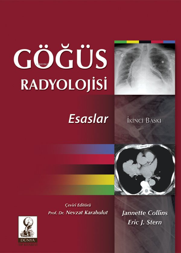 Göğüs Radyolojisi:Esaslar