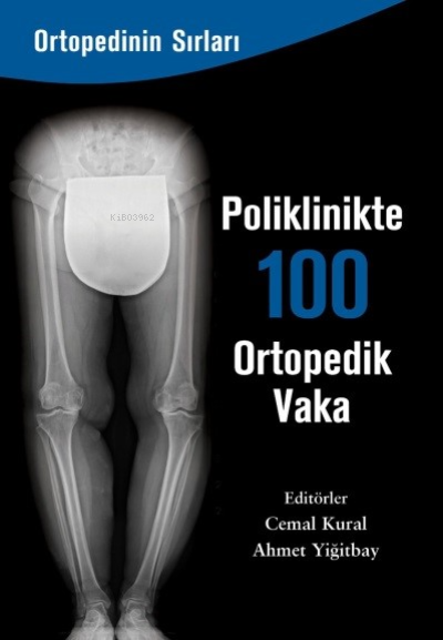 Poliklinkte 100 Ortopedik Vaka