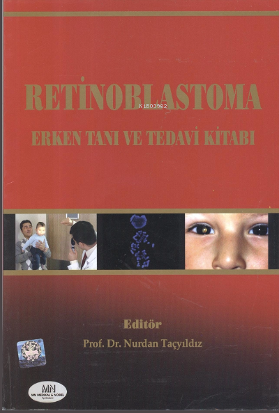 Retinoblastoma Erken Tanı ve Tedavi