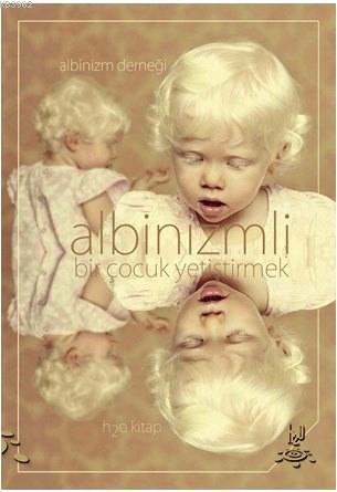Albinizmli Bir Çocuk Yetiştirmek; Albinizm Derneği